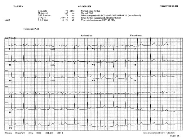 ekg2.jpg